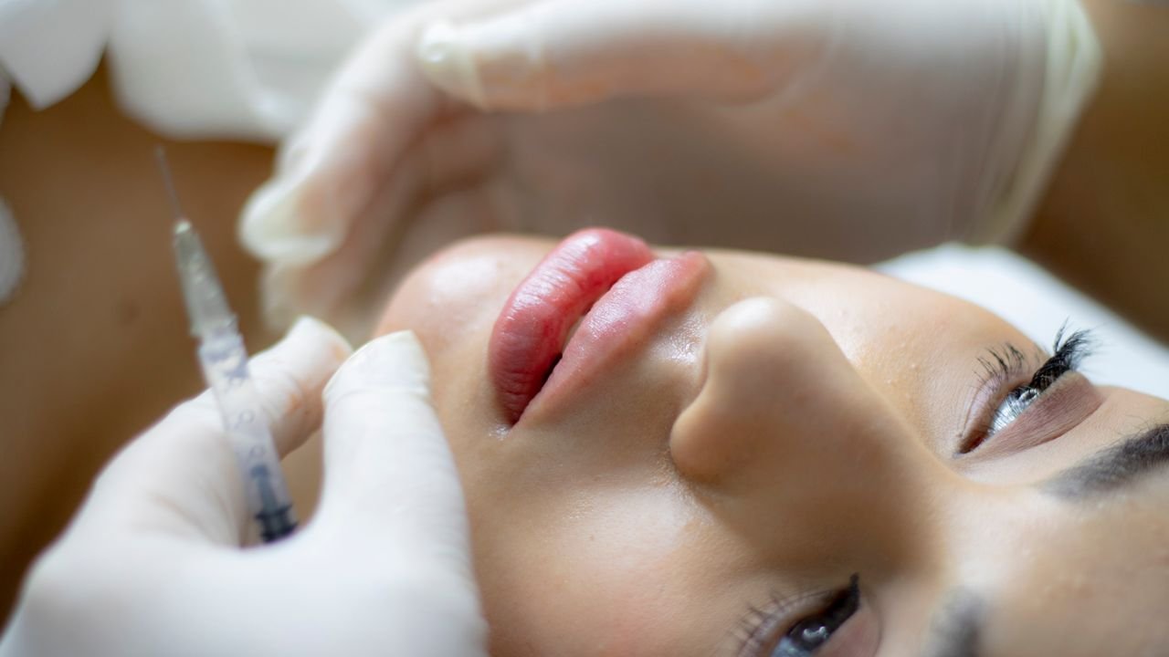 Dermal Fillers Treatment at Facethetics Beauty